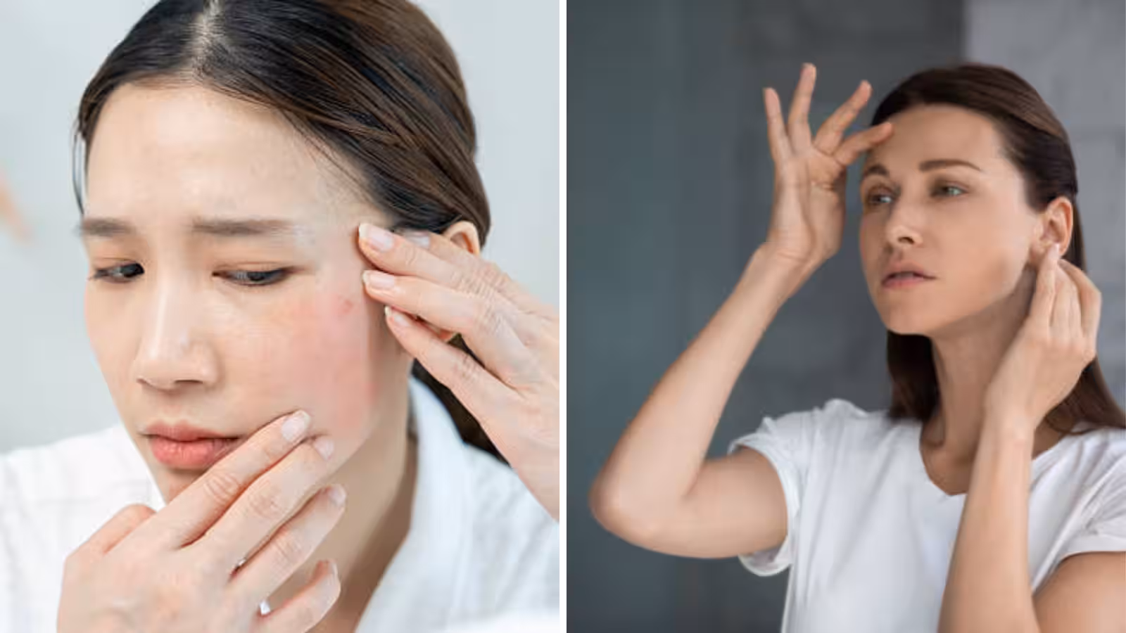 DIY Skin Care: चेहरे की ड्राईनेस से परेशान हैं तो घर पर बनाएं मॉइस्चराइजर, आसान है तरीका